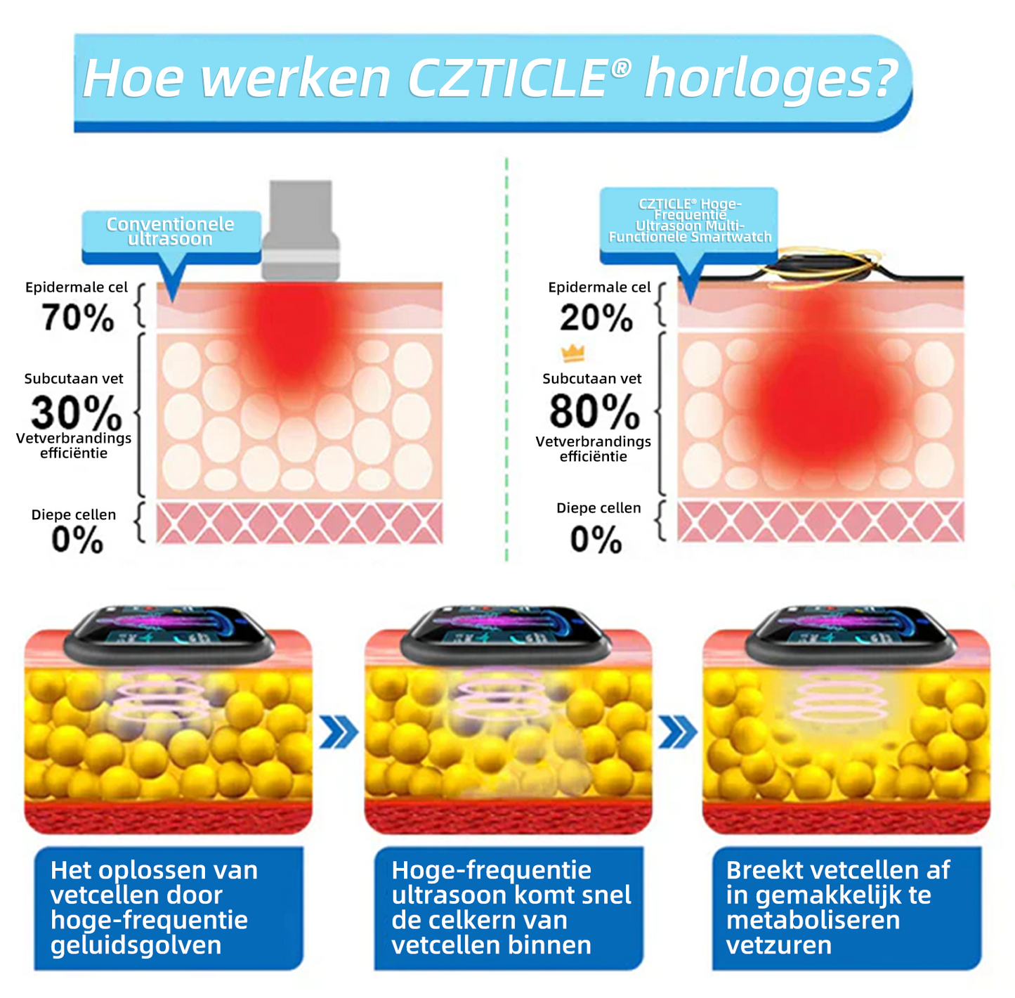 CZTICLE® Hoogfrequent Ultrasound Multifunctioneel Smartwatch🔥🔥💃(Speciaal ontworpen voor vetverbranding, bloedsuikerbalans, lymfedetox, oedeemreductie en zenuwontspanning)