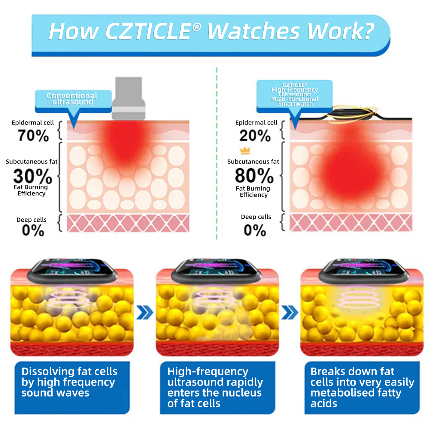 CZTICLE® Hoogfrequent Ultrasound Multifunctioneel Smartwatch🔥🔥💃(Speciaal ontworpen voor vetverbranding, bloedsuikerbalans, lymfedetox, oedeemreductie en zenuwontspanning)