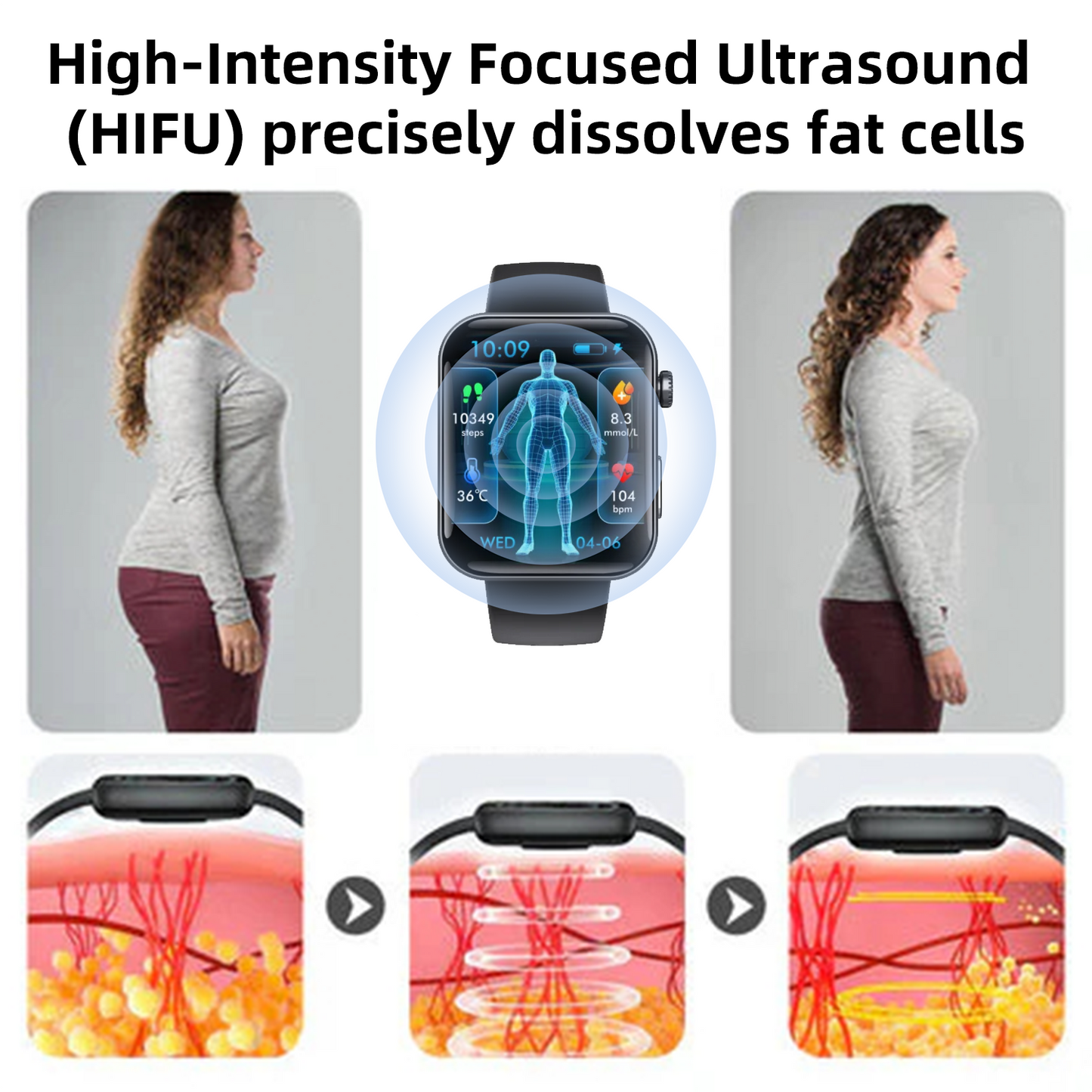 CZTICLE® Hoogfrequent Ultrasound Multifunctioneel Smartwatch🔥🔥💃(Speciaal ontworpen voor vetverbranding, bloedsuikerbalans, lymfedetox, oedeemreductie en zenuwontspanning)