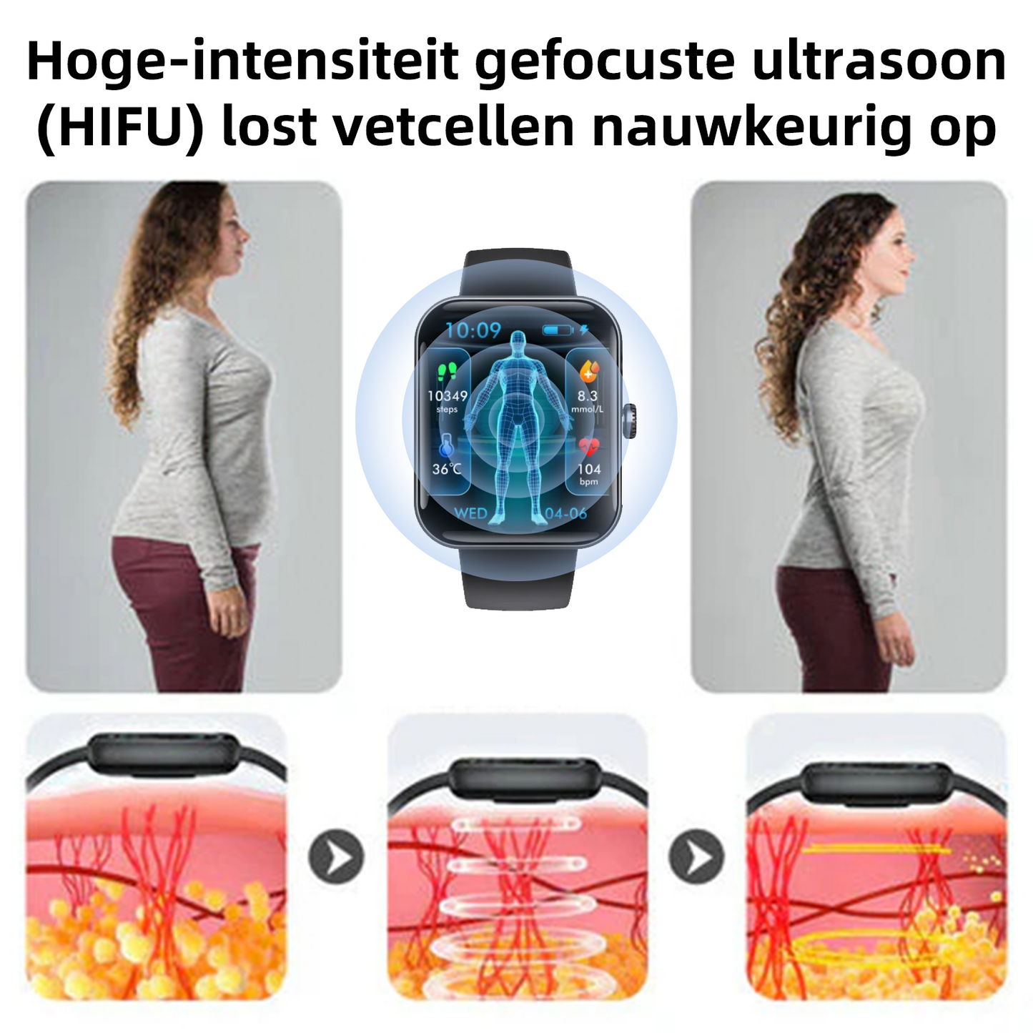 CZTICLE® Hoogfrequent Ultrasound Multifunctioneel Smartwatch🔥🔥💃(Speciaal ontworpen voor vetverbranding, bloedsuikerbalans, lymfedetox, oedeemreductie en zenuwontspanning)