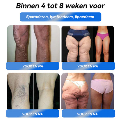 IFMAGIC® GLP-1 Orale oplossing voor gewichtsverlies✅Eén dosis per dag – resultaat zichtbaar binnen 7 dagen👩‍⚕️ Geschikt voor obesitas, hart- en vaatziekten, diabetes, slaapapneu, hoge cholesterol en hoge bloedvetten, gewrichtsproblemen, enz🌿