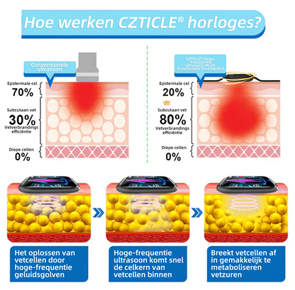 CZTICLE® Hoogfrequent Ultrasound Multifunctioneel Smartwatch🔥🔥💃(Speciaal ontworpen voor vetverbranding, bloedsuikerbalans, lymfedetox, oedeemreductie en zenuwontspanning)
